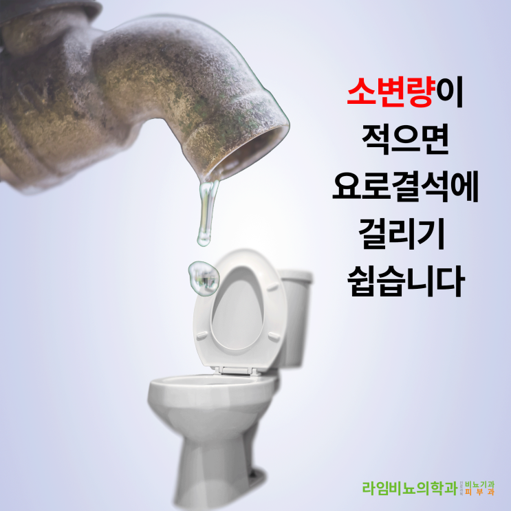  요로결석 시리즈 - 세 번째, 대구동구비뇨기과에서 알려드리는 나는 왜 요로결석이 계속 생길까?