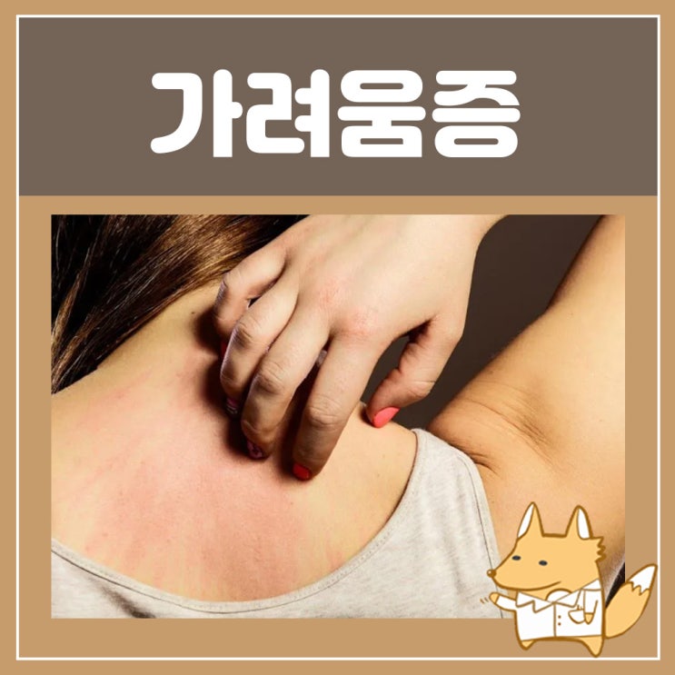  옴진드기 증상 : 옴 증상 치료법 몸 머리 등 피부 가려움증 연고 손가락 손 가려움
