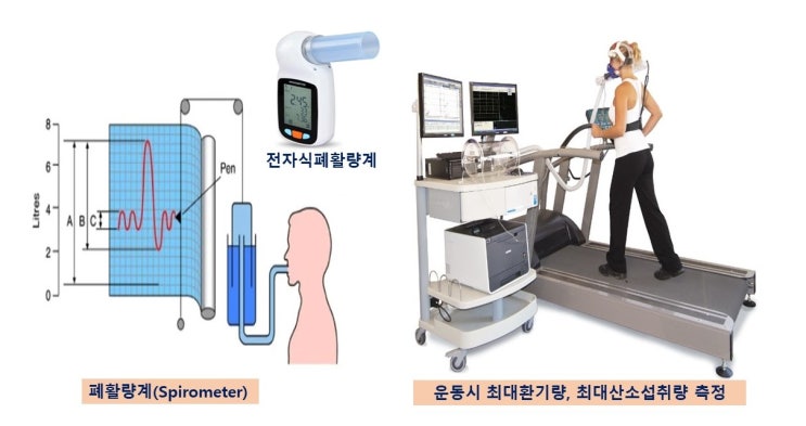 폐활량(Vital Capacity), 최대산소섭취량(VO2max)의 제한요인, 최대수의적환기량(MVV)과 최대운동환기량