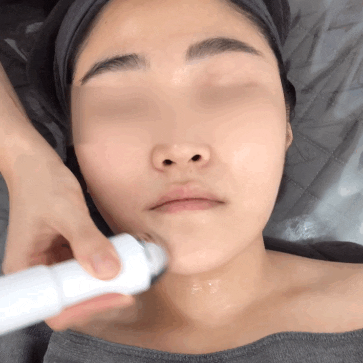  송도피부관리 유나스킨 물방울 하이푸 리프팅 관리 최고네요