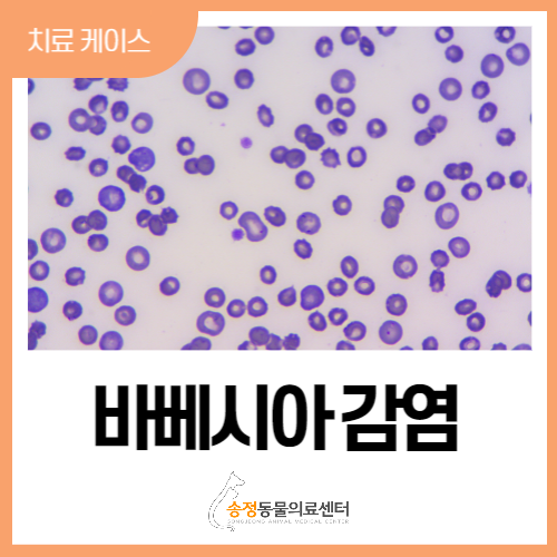  [내과] 빈혈 일으키는 바베시아 진드기 감염증, 다시 발생할 확률 높은 이유와 치료법(경기 광주 분당)