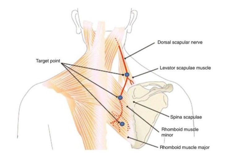  견갑배신경(dorsal scapular nerve)