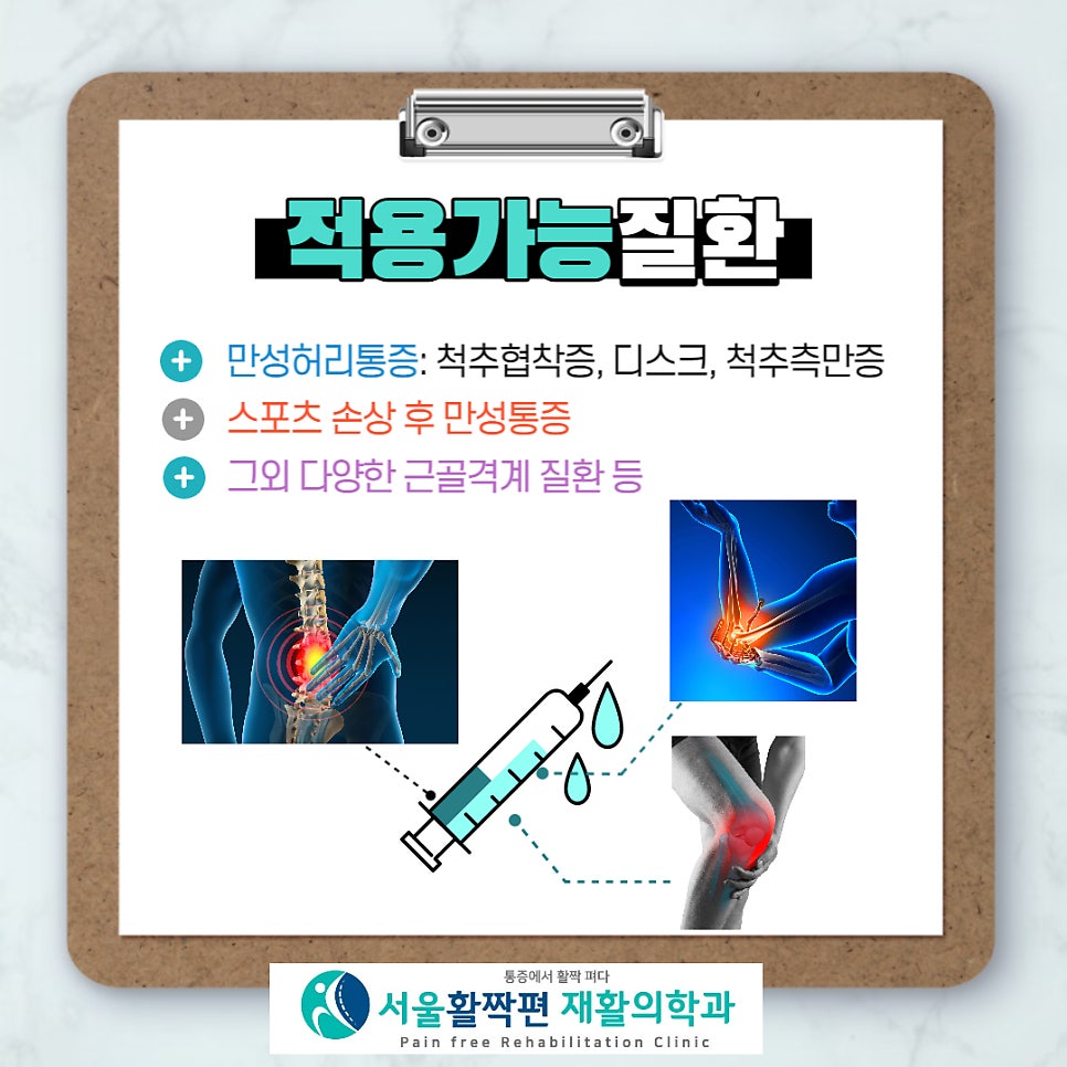 프롤로 치료! 증식치료! — 본문 그림