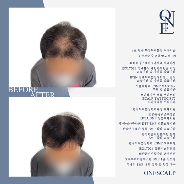  남포동두피문신 본인 머리처럼 자연스럽게 하는 곳?