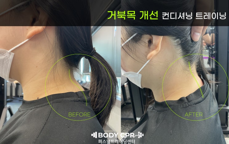  [노원PT]거북목 체형교정,다이어트피티, 학생PT 후기-중계PT