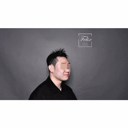  김포SMP잘하는곳 찾고계신가요?탈모커버 두피커버 숱채움 잘하는곳 필릭스 스칼프~!(김포 제물포 군산 양주 강남 인천 부천)