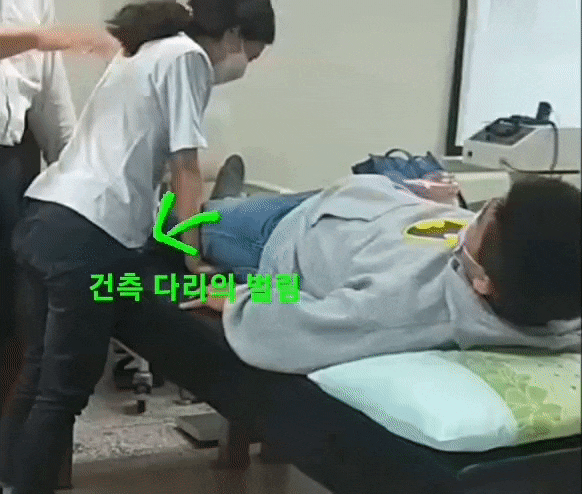  굽힘 / 폄 공동운동 패턴(Flexion / Extension synergy pattern)과 연합반응(Associated reaction)