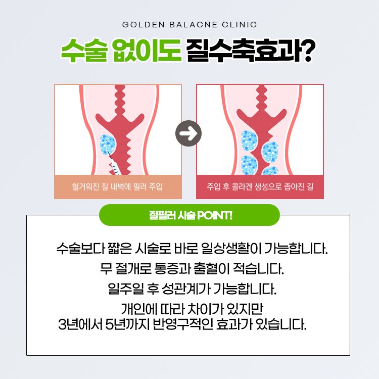 질 필러 후 질 수축에 레이저 치료가 중요한 이유 알아보기