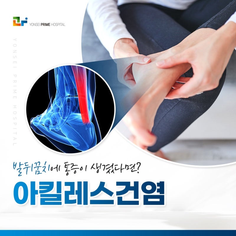 아킬레스건 파열 부상 5