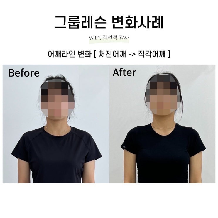  [대구SNPE 리셋바디] 그룹수업만 열심히 참여했을 뿐인데 제니어깨가 되신 우리 회원님