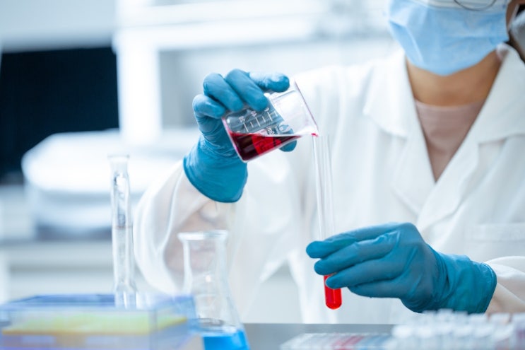  HDL 콜레스테롤 수치 지나치게 높으면?(남성 주의)