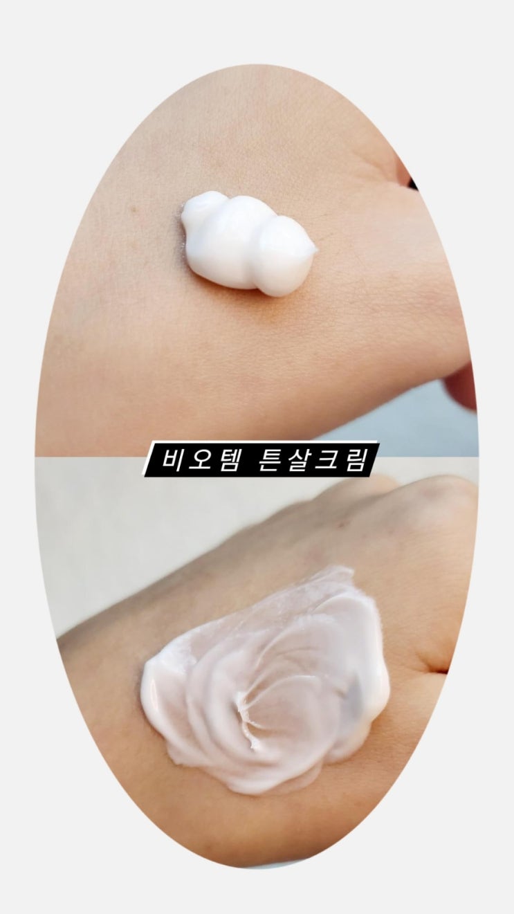  [내돈내산] 임산부 튼살 원인과 꿀팁 / 튼살 크림 추천 비오템 찐리뷰 ️