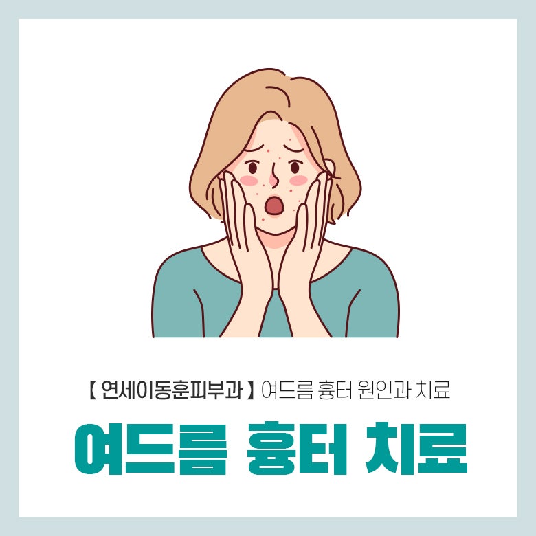 순천 연세이동훈피부과, 여드름 흉터 원인과 치료방법은?