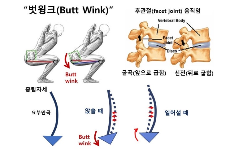 스쿼트(Squat)의 벗윙크(Butt Wink), 비기능성 요추골반리듬(lumbopelvic rhythm)