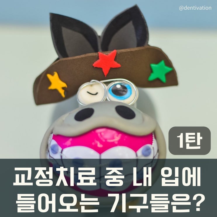  교정치료 중 내 입에 들어오는 기구들은? (1탄)