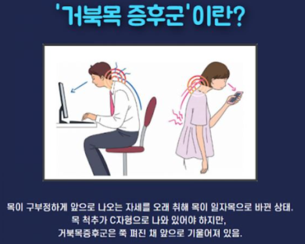  거북목 증후군 원인과 자가진단 및 예방법 알아보기