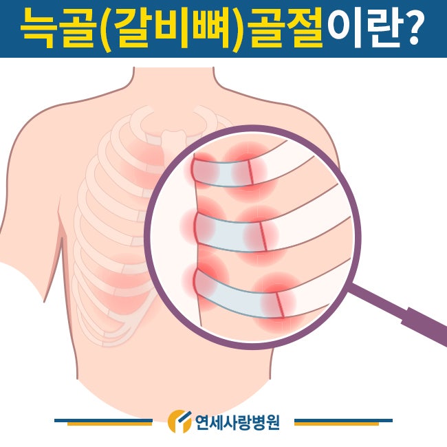 갈비뼈 금갔을때 증상과 대처방법 : 네이버 블로그 갈비뼈 금갔을때 증상과 대처방법 : 네이버 블로그