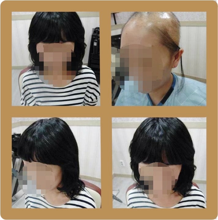 대구 항암가발 후회없는 선택을 하고 싶다면 'click' [대구 위풍당당] 4