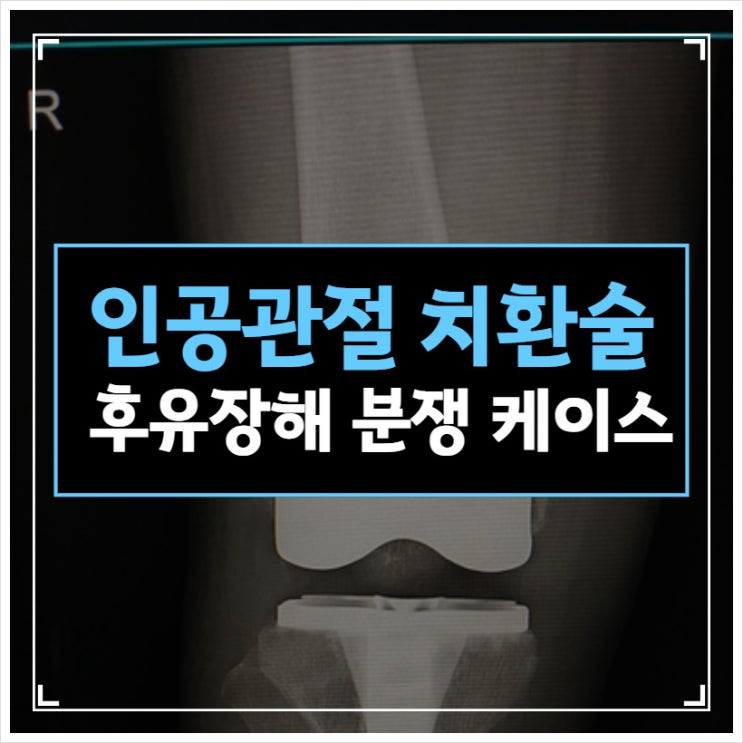 인공관절 치환술 후유장해 보험금 분쟁 케이스