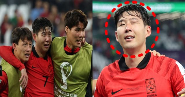  "이 상태로 뛴거야?"...손흥민, 경기 종료 후 공개된 얼굴 상태에 모두 눈믈흘렸다