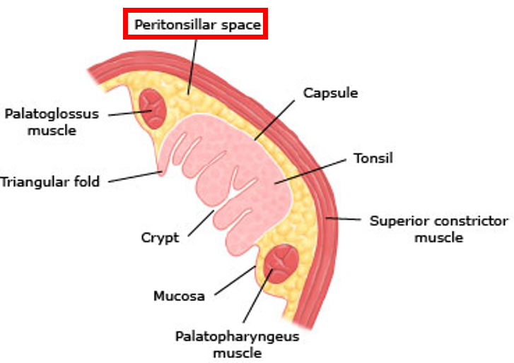 편도주위농양(peritonsillar abscess) - 편도염이 낫지 않고 고름이 찼어요!! : 네이버 블로그