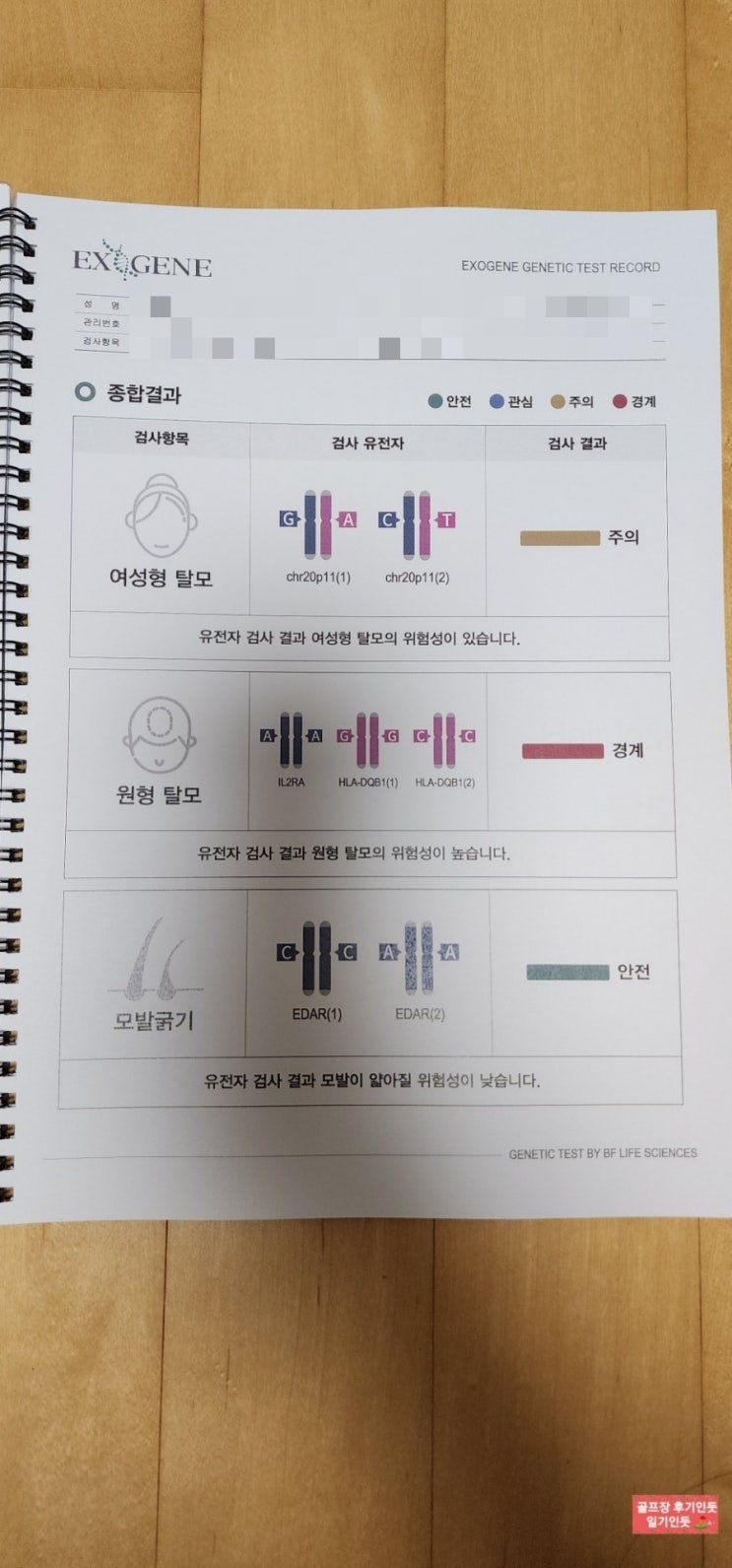  탈모 유전자 예측검사 후기(엑소진 탈모유전자 검사키트)