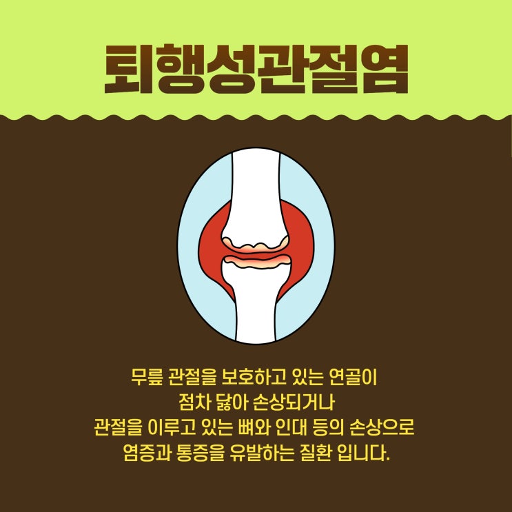  안산정형외과 무릎이 자꾸 아프다면
