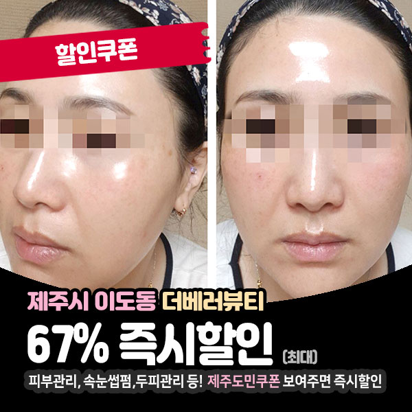  12월 초특가로 저렴하게 이용가능한, 제주피부관리! 더베러뷰티