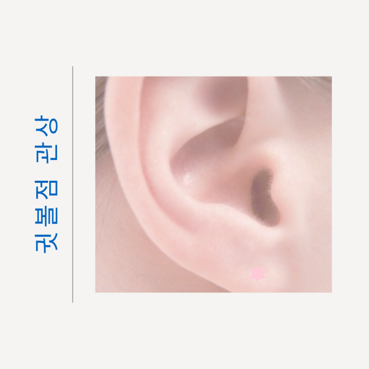 귓볼점 귀 점 관상 해석 정리 귓볼점 귀 점 관상 해석 정리