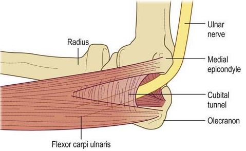  척골신경(Ulnar nerve) 새끼손가락 저림!