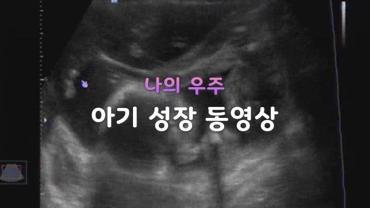  나의 우주 아기 성장 동영상