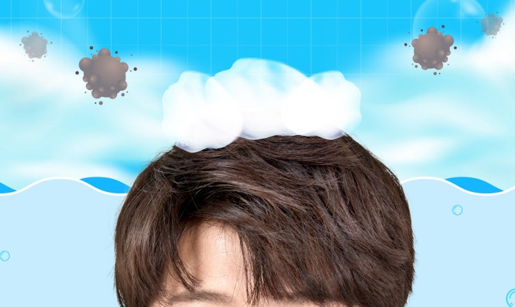  지루성 두피염 관리, 항진균제/스테로이드 사용 어떻게 할 것인가?