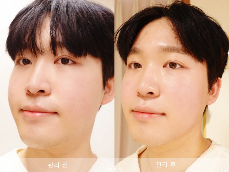  긴 얼굴 경락 마사지 위뷰티에서 관리받아요