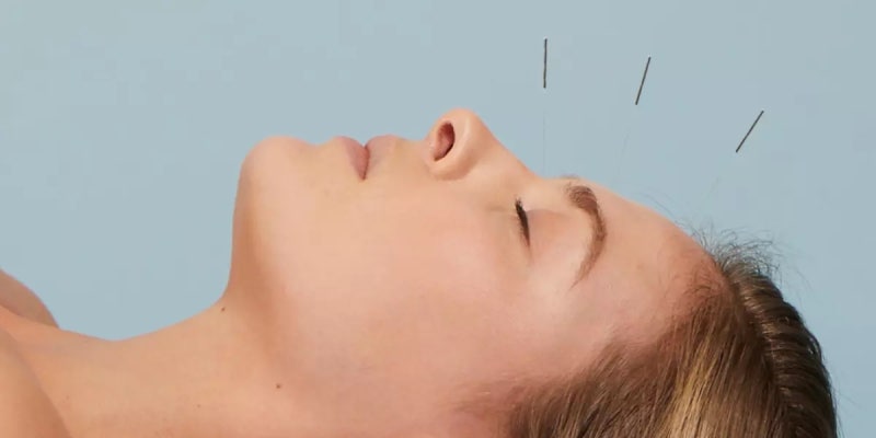 트렌디한 미국의 침 클리닉 - ORA : 네이버 블로그