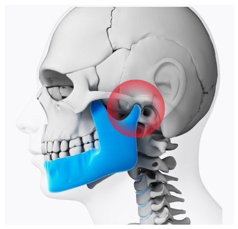 [전주 강산한의원, 턱관절장애] TMJ 에 대한 기본적인 이야기들