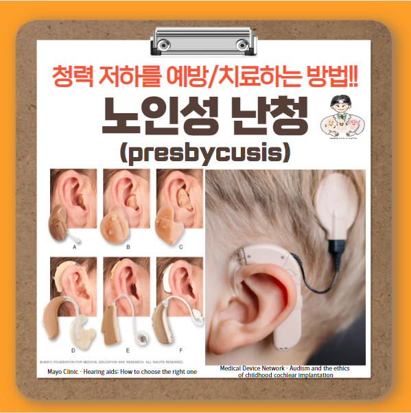  노인성 난청(presbycusis) (2) - 예방과 치료
