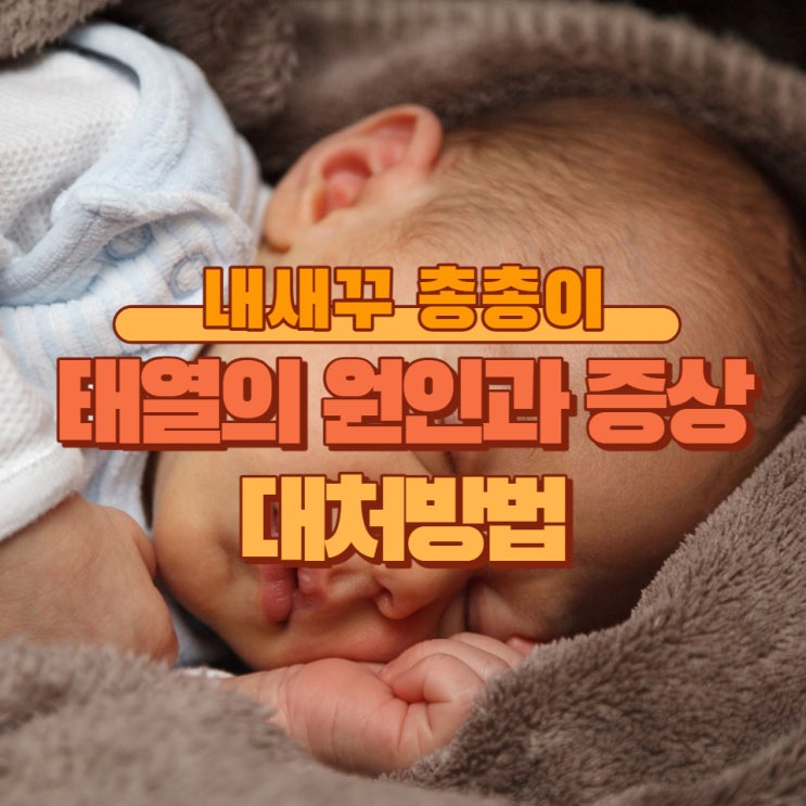  아기 신생아 태열 원인과 대처 방법