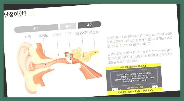  보청기전문  귓속보청기 국가정부지원 보청기 흐믓