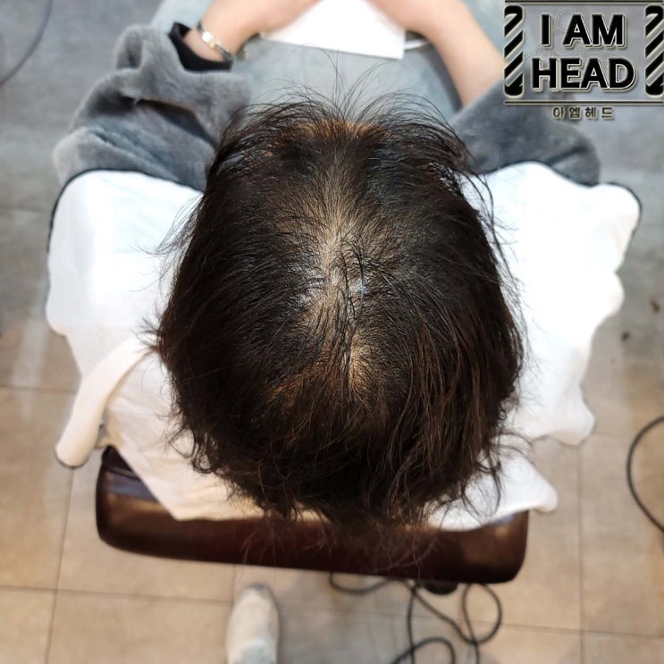  율전동 미용실 남자탈모 커버펌, 링거펌으로 자연스럽게 숱 채우기