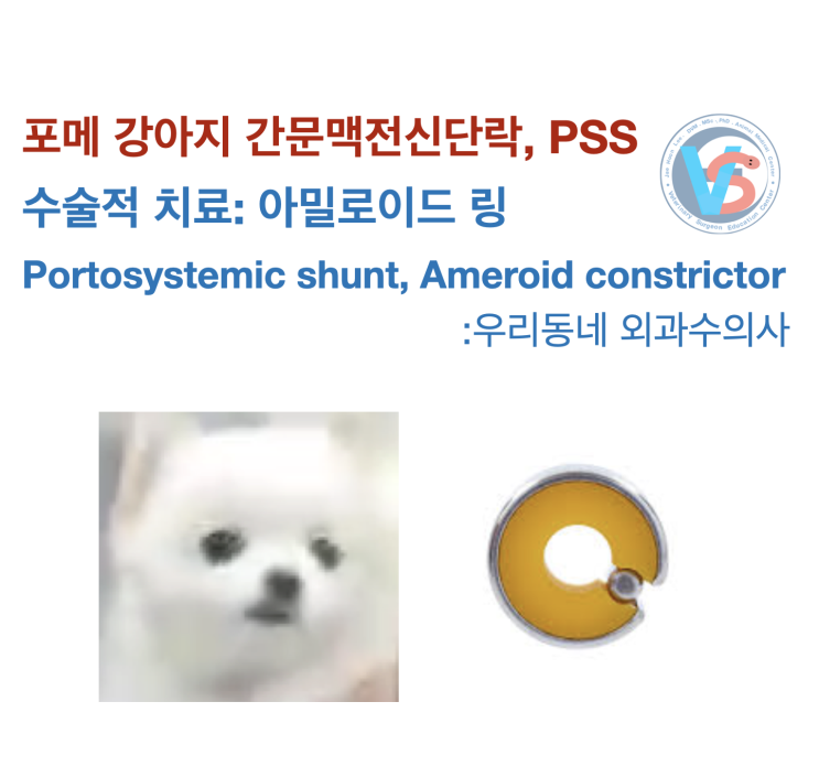  포메 강아지 간문맥전신단락,PSS (Ameroid constrictor, 아밀로이드링) 수술적 치료