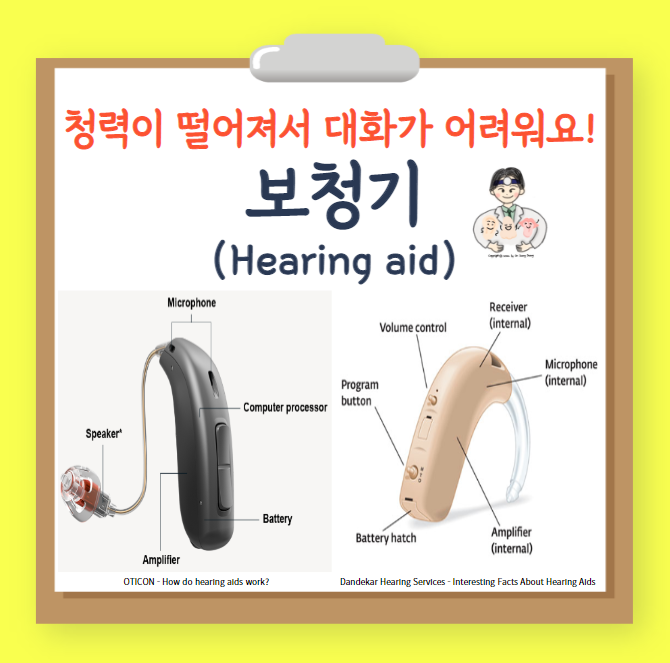  보청기(hearing aid) (1) - 구조 및 구성품