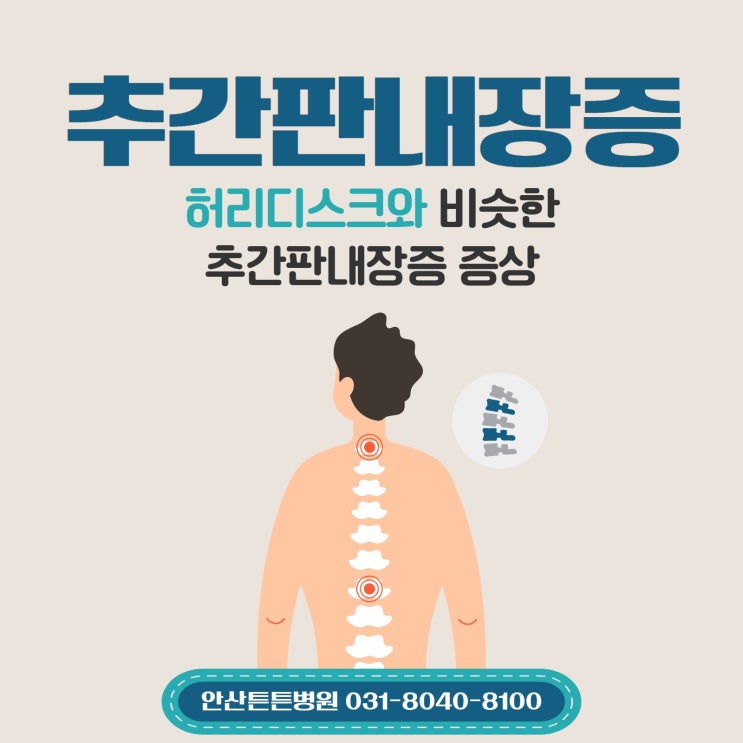  안산허리디스크와 비슷한 추간판내장증 증상