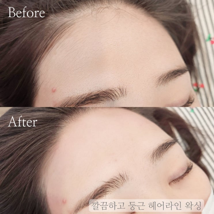  울산 북구 헤어라인 왁싱 후 관리방법