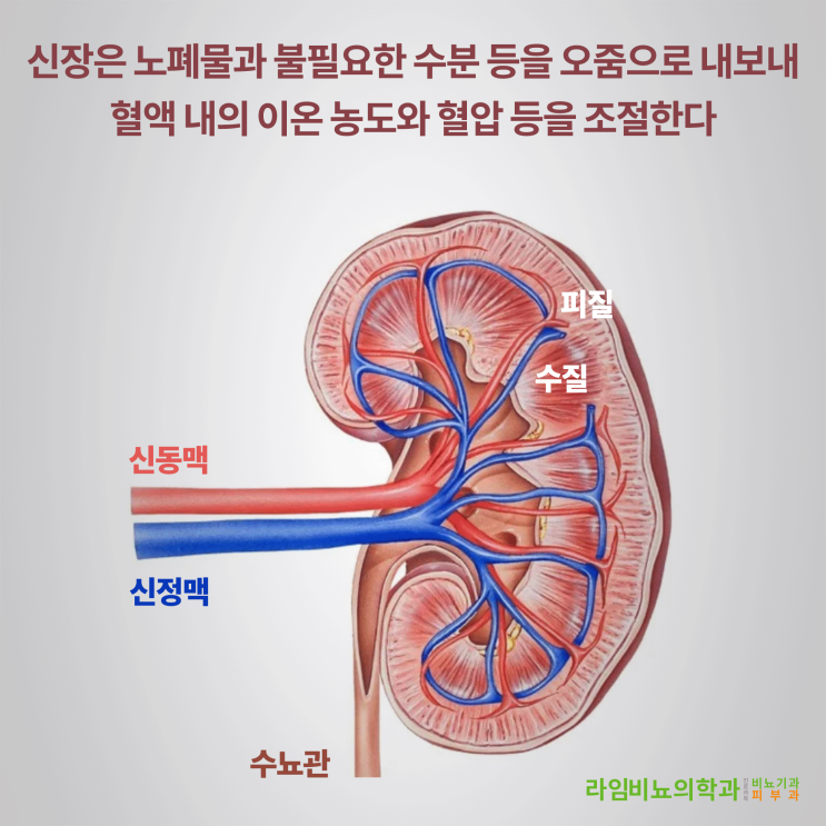  오른쪽 신장 통증의 원인 - 세 번째 - 대구 동구 라임비뇨의학과와 알아보는 신정맥 혈전증과 신장 암