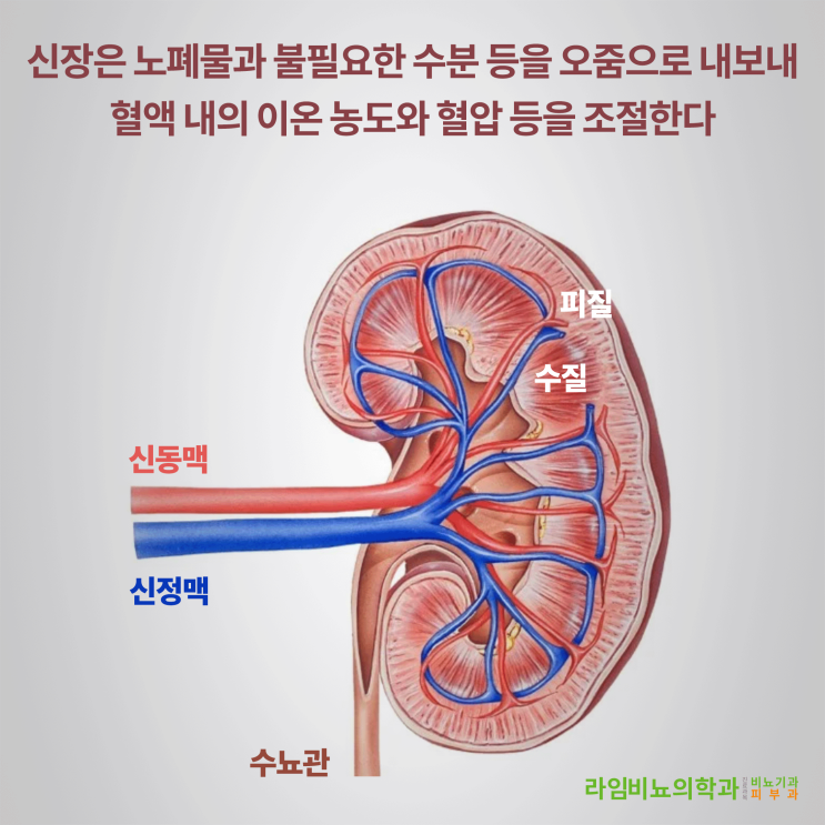 오른쪽 신장 통증의 원인 - 세 번째 - 대구 동구 라임비뇨의학과와 알아보는 신정맥 혈전증과 신장 암