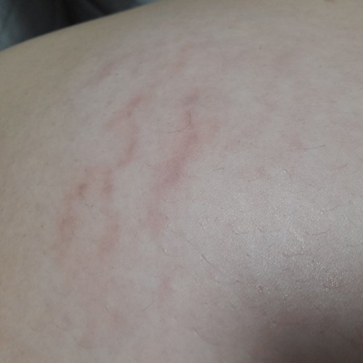  [뿅이 26주] 나는 임산부 나는 점점 늙어간다?! - 임산부변화