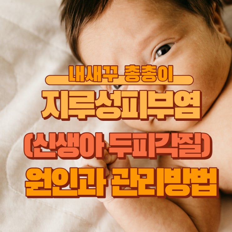  아기 신생아 두피 각질 지루성 피부염 원인과 관리방법.
