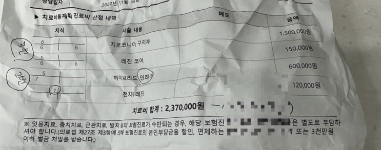  분당치과237만원 충치견적받고 용인치과에서 약 62만원 나온 후기