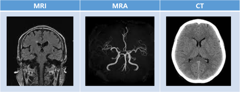 뇌 MRI, MRA, CT 차이 확인! feat. 어떤사람들이 받아야 될까요? : 네이버 블로그