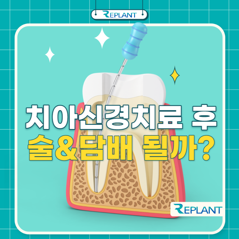 이빨신경치료 술 담배 언제부터 가능할까?